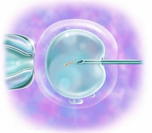 案例